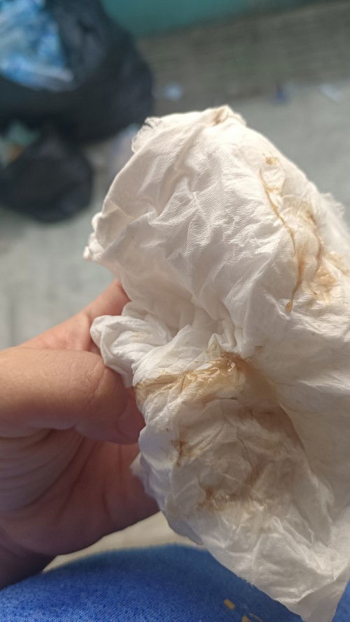 มูกสีน้ำตาล