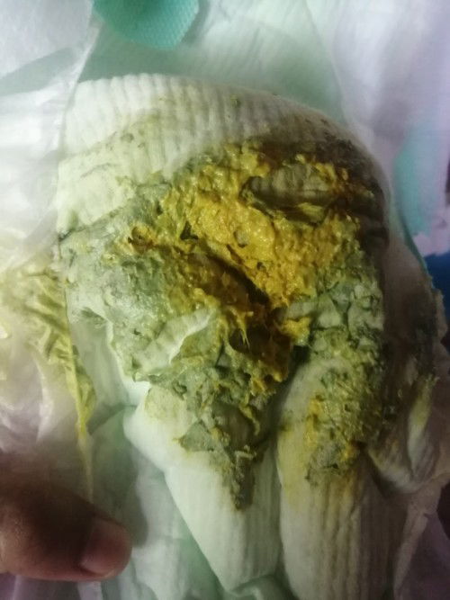 Warna tahi babyi normal kaaa