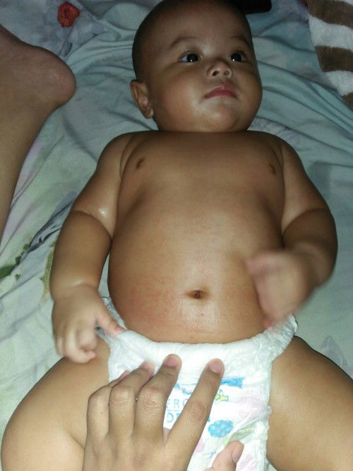 Bintikbintik merah bayi 4 bulan