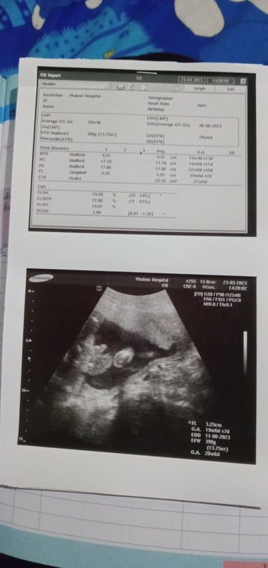 แม่ๆบ้านไหนมีวิธีเพิ่มน้ำหนักลูกในท้องบ้างคะ