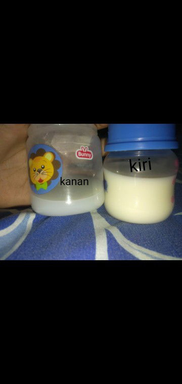 Air Susu Asi Kanan Kiri Berbeda