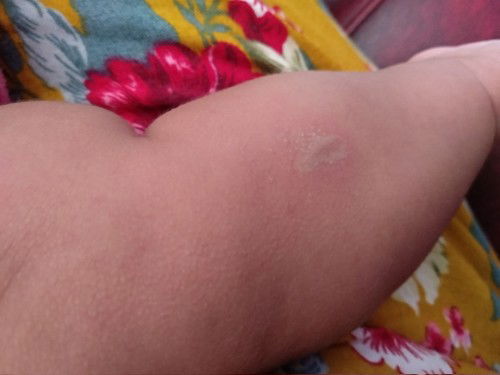 Maaf adakah yg pernah mengalami kenapa ya?