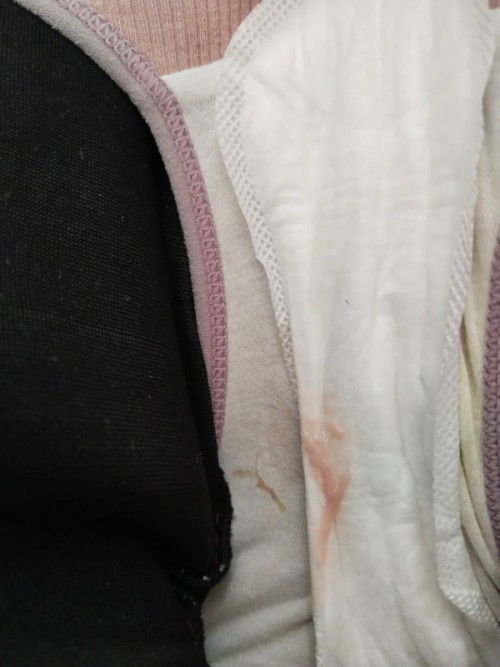 Spotting atau keputihan ye ? Ada sesiapa penah mengalaminya tak?