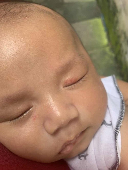 merah di kelopak mata