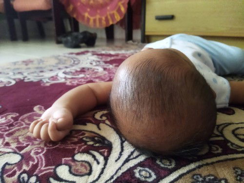 Kepala anak saya peyang bun, kira² bisa balik normal kmbli gk ya bun,umur 3 bulan?