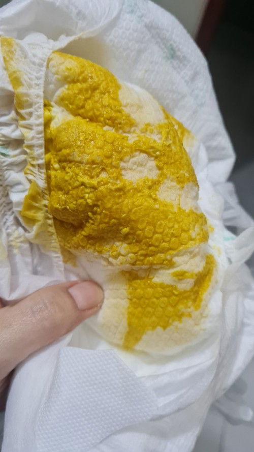 Pup bayi normal 4 bulan