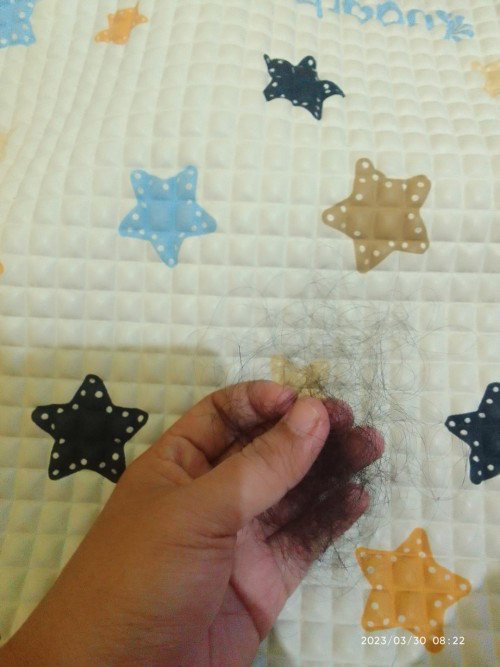 Rambut rontok saat bayi fase oral