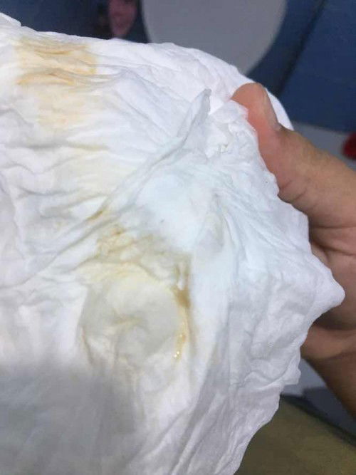 แบบนี้ควรทำยังไงดีค่ะ