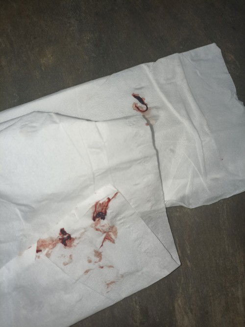 Apakah ini artinya keguguran?