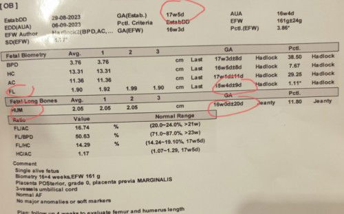 ทารกแขนขาเล็กกว่าอายุครรภ์