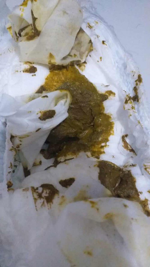 Ee nya sembelit atau normal