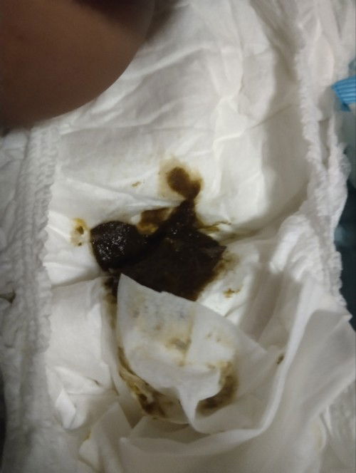 สีอึลูกแบบนี้ผิดปกติไหมคะ