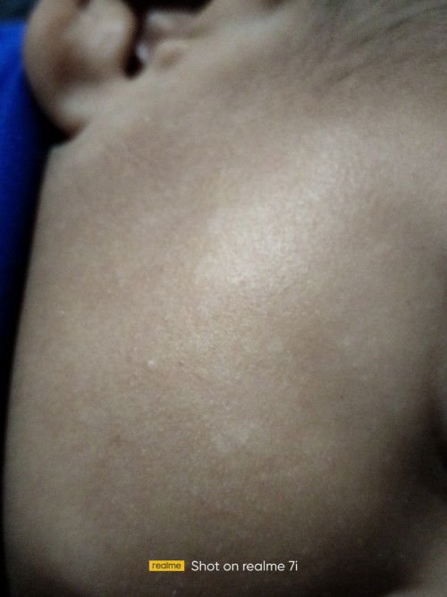 PUTIH KAYA PANU Di wajah