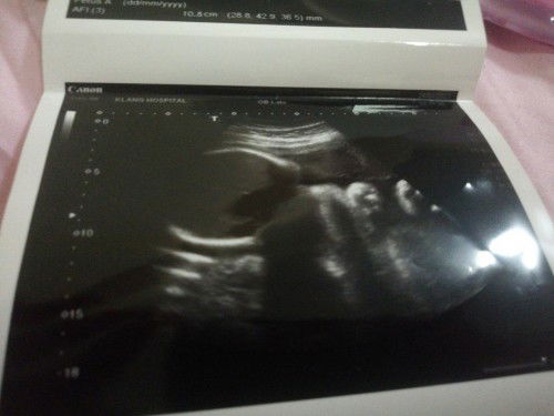 แม่ๆช่วยดูหน่อยคะว่าหญิงรึชายหมอบอกไม่ชัดเจนเลยคพ