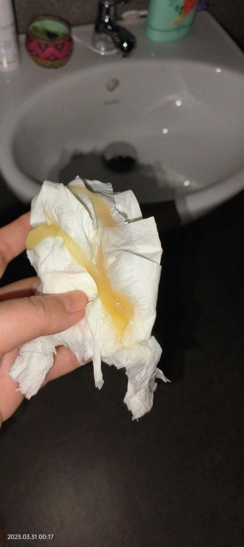 TMI picture - discharge