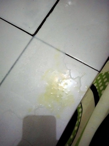 Bun mau tnya, bayi ada yg sama ga muntah ada cairan kuning nya