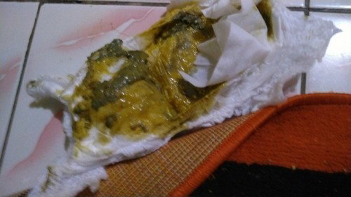 Maaf agak jorok ya bunda bunda mau tanya gejala hisprung