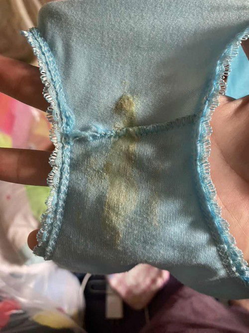 ตกขาว สีเหลืองเกิดจากอะไร