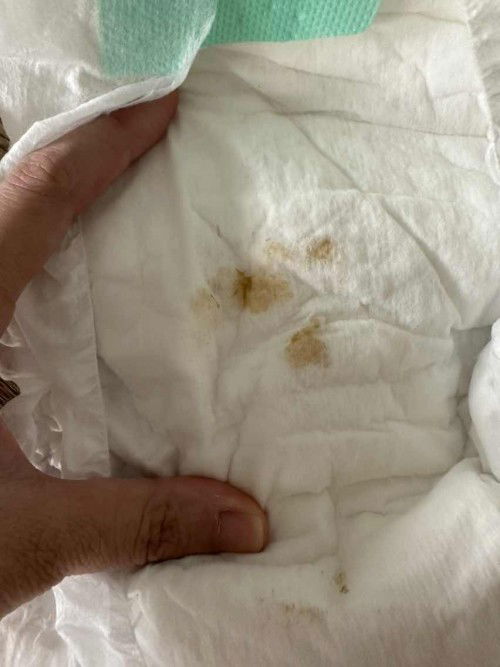 น้องตดแล้วเป็นสีนี้