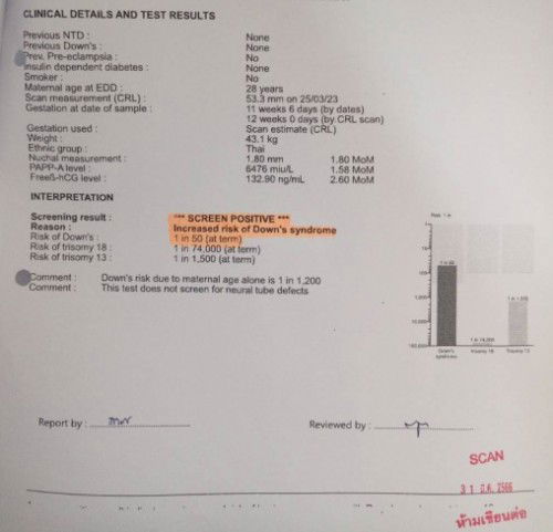 ตรวจเลือดคัดกรองดาวน์ความเสี่ยงสูง