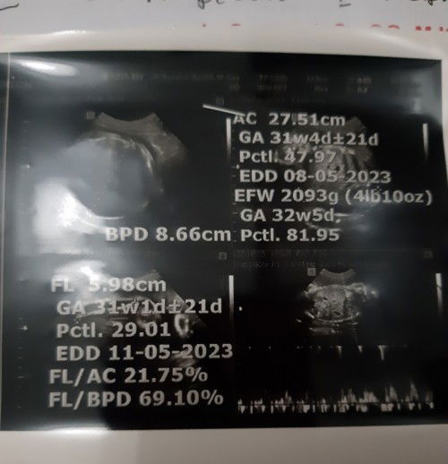 bun kok hpl beda"iya yg bener ikutin hpl awal usg apa gimna? pas awal usg tgl 20 april bidan 21april