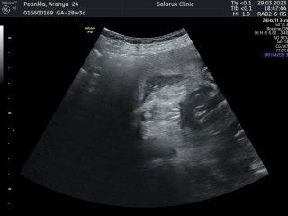 ช่วยดูเพศน้อนให้หน่อยค่ะ