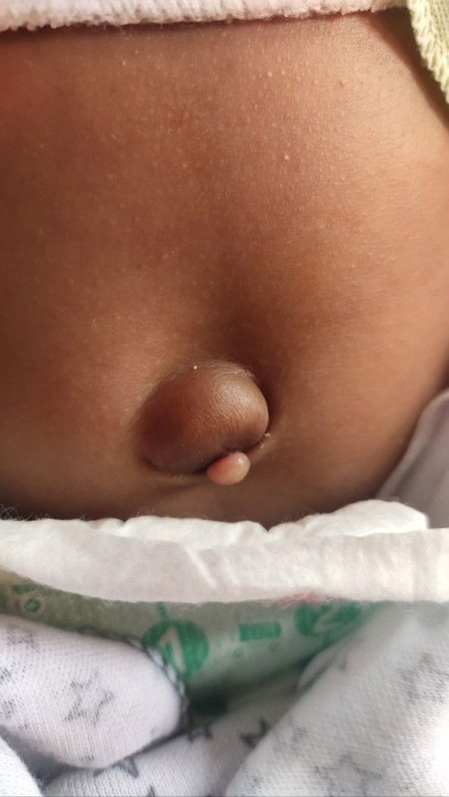 Binggung cara atasinnya