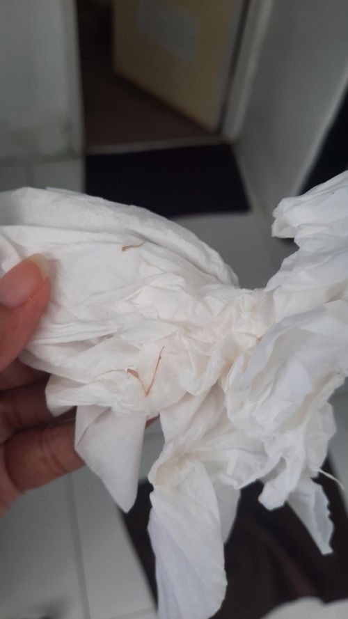 Hamil 8 minggu flek coklat