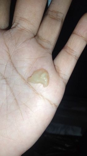 Lendir apa kah ini