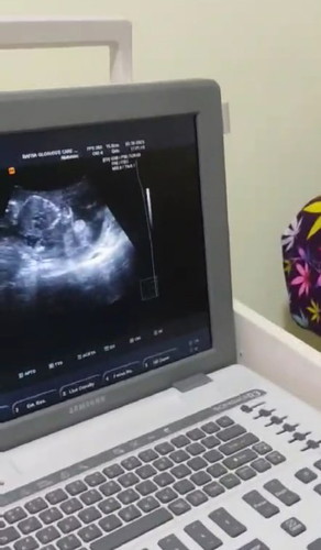 Girl or Boy?