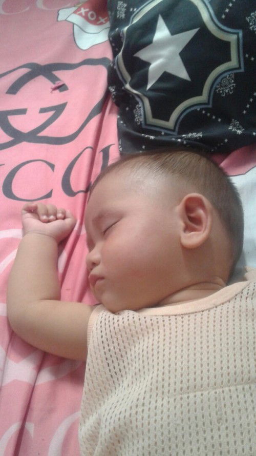 น้องเป็นผดผื่นอะไรคะ