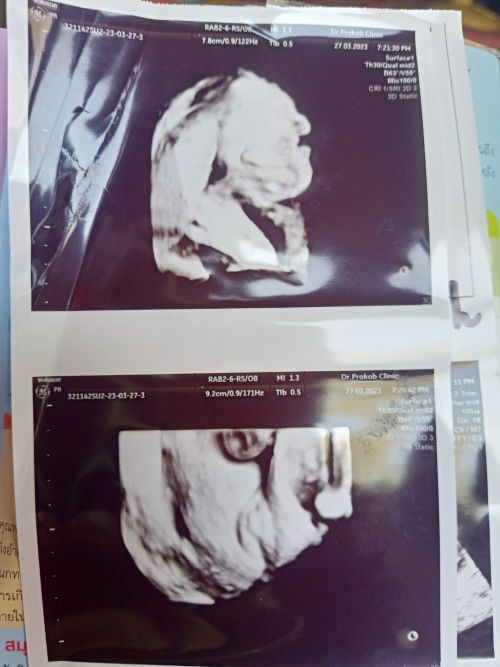 ทีมมิถุนายน