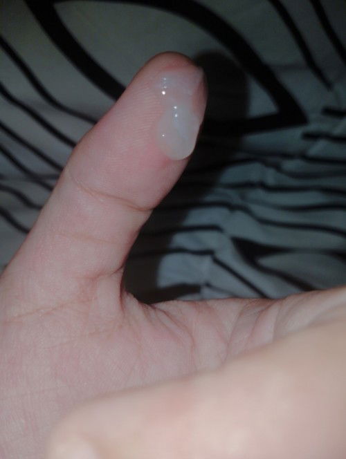 Usia kehamilan 39w 3d