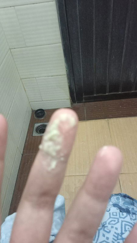 Keputihan berwarna hijau