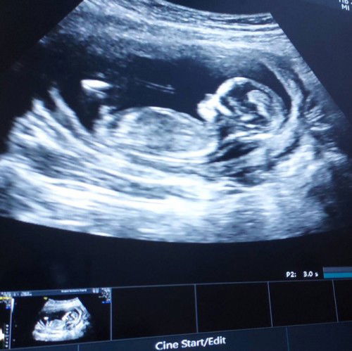 เจ้าตัวเล็กในวัย 13 วีค