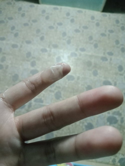 อันนี้คือมูกหรือตกชาวคะ