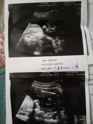 สอบถามครับ