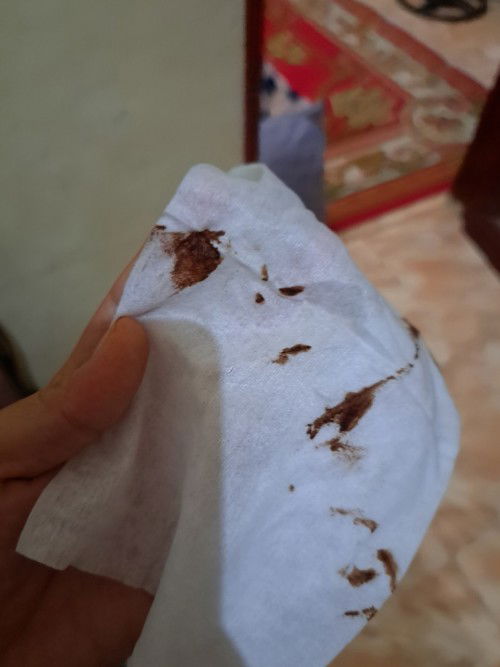 Maap ya bun kalo jorok atau gmna soalnya rada takut kalo udah flek hitam