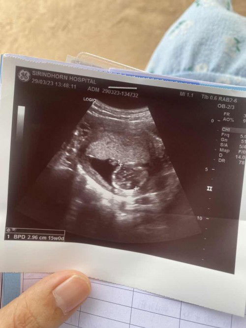 15w เห็นเพศตัวเล็กกันหรือยังค่ะ