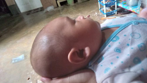 Cara atasi kepala peyang