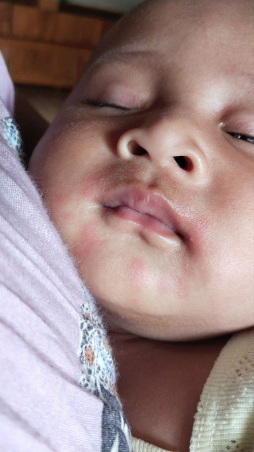 Merah" disekitar mulut