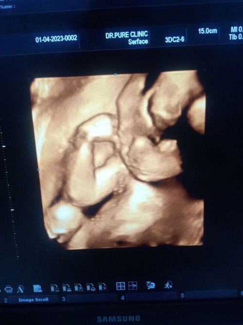 กลืนน้ำตาลรอบแรก