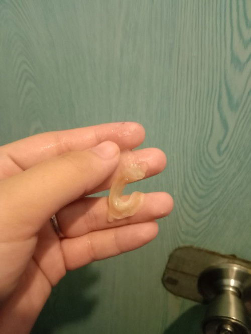 Hello po. Sumasakit po Ang puson ko parang naninigas and likod bewang normal poba ito? 10 weeks preg