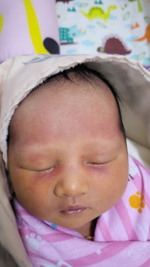 Muka bayi merah merah