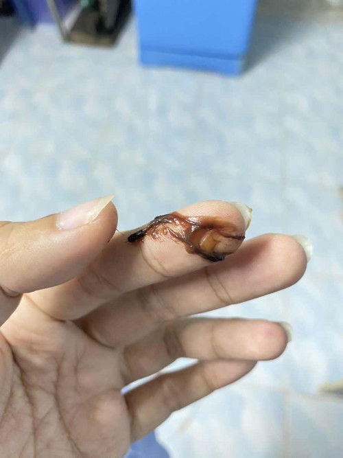 ท้องได้ 6 เดือนแล้วค่ะ แต่มีลักษณะแบบในรูปออกมา