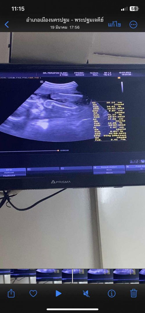 ลุ้นเพศลูกชายหรือหญิง