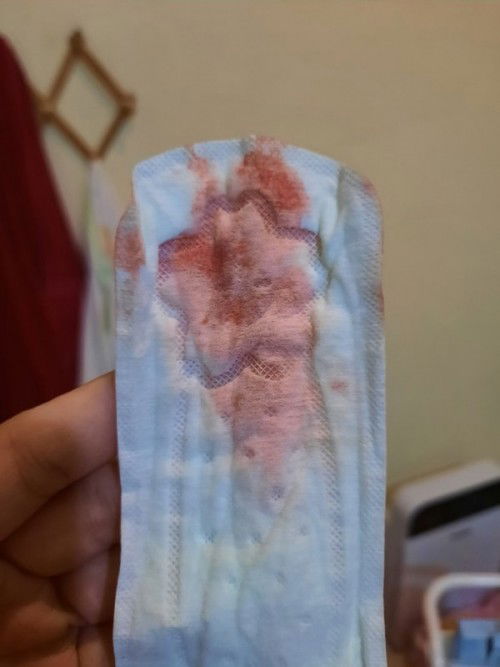 ผ่าคลอด น้ำคาวปลากับเลือดยังไม่หมดเลยค่ะ1เดือนแล้ว