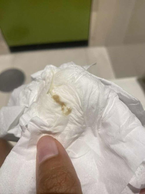 ท้อง 12W แล้วมีตกขาวปนสีน้ำตาลออกมานิดนึง