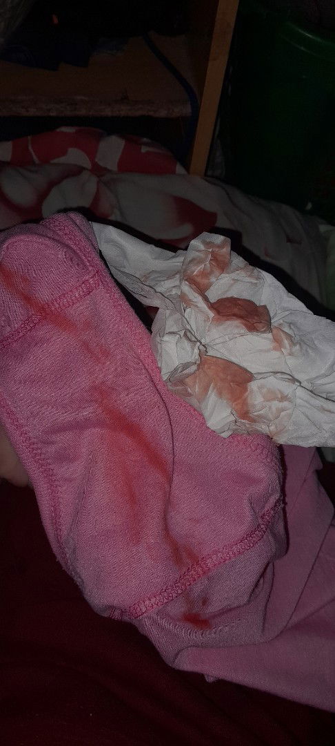 Keluar lendir dan darah