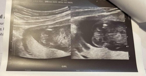 Baby’s Gender Revealed at 16 Weeks!